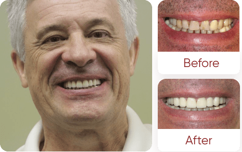 Family Dentistry of San Antonio Anatoliy patient