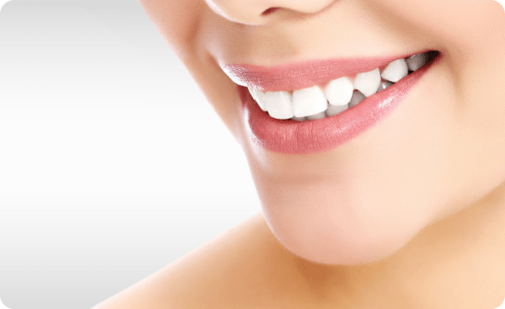 Family Dentistry of San Antonio home bleaching procedure Family Dentistry of San Antonio home bleaching procedure