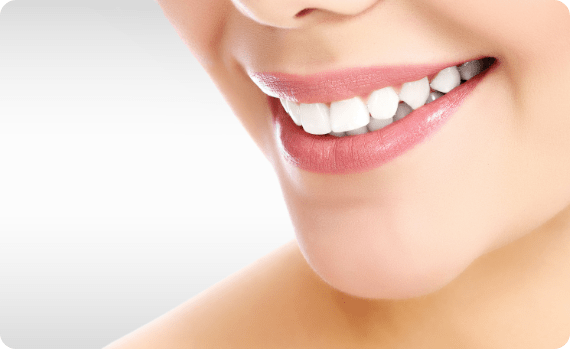 Family Dentistry of San Antonio home bleaching procedure